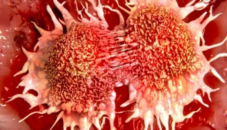 Νέα ανησυχητική έρευνα για τον καρκίνο – Τα πράγματα που πρέπει να αποφεύγετε